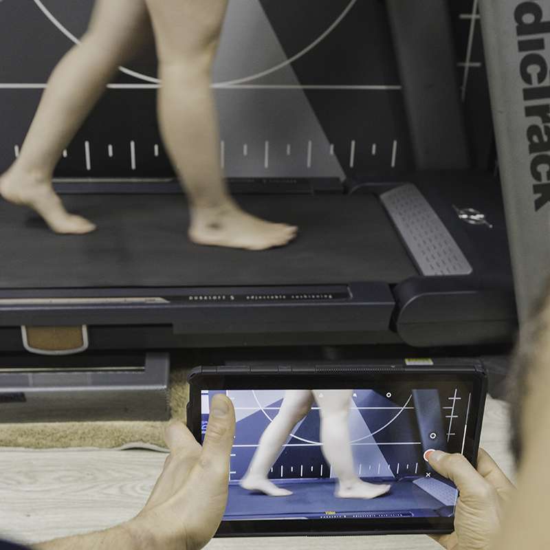 Estudio biomecánico-Estático y dinámico